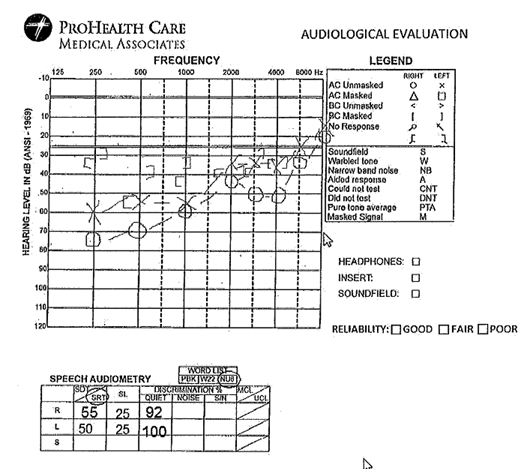 Audiologist's Report/Audiogram Example